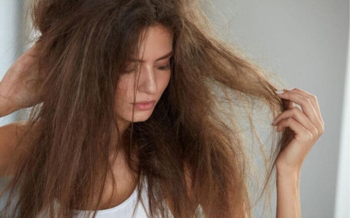 Natural Ways To Prevent Your Hair Fall