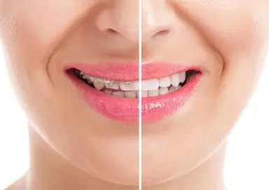 Beauty Tips To Create A Beautiful Smile